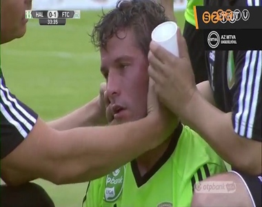 Megm�t�tt�k Halmosi arc�t