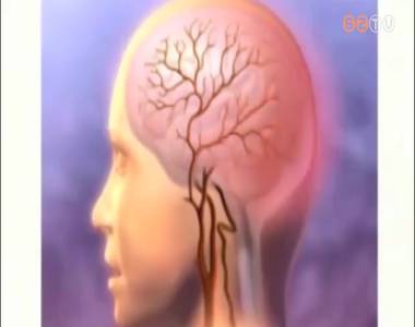 Agyh�rtyagyullad�s