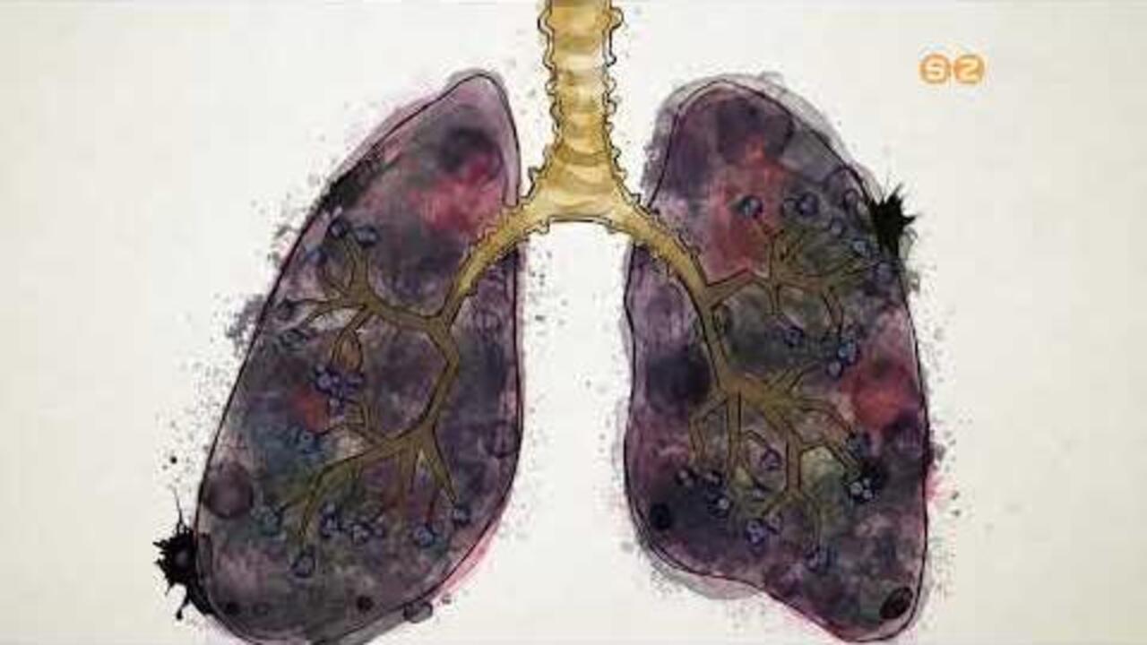 Az EFI szakemberei kiemelten fontosnak tartj�k a doh�nyz�sr�l leszok�st seg�t� programot