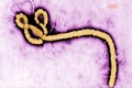 A Markusovszky-kórházban is készülnek az ebola-járványra A Markusovszky-kórházban is készülnek az ebola-járványra